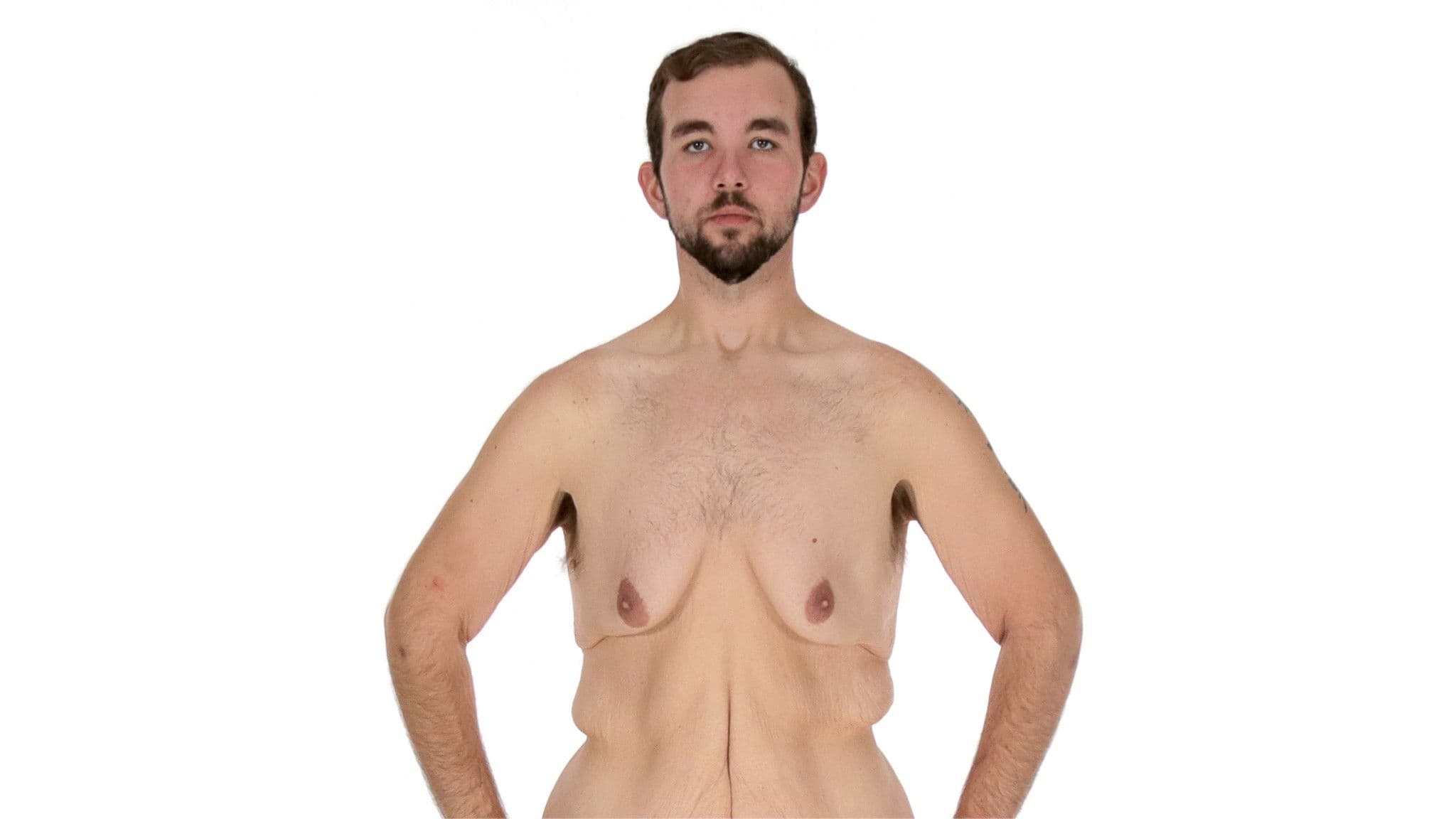 Mein Leben mit 300 kg