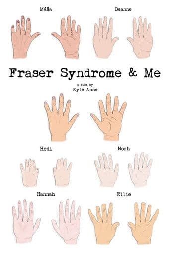 Fraser Syndrome & Me