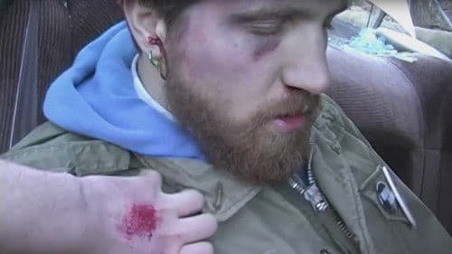 Hulk Blood Tapes Bild 1