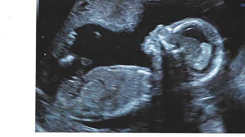 Quiero ser tu madre Bild 2