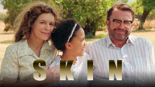 Skin - Schrei nach Gerechtigkeit Bild 6