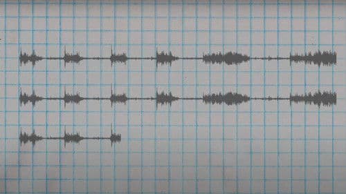 Pattern Recognition Bild 1