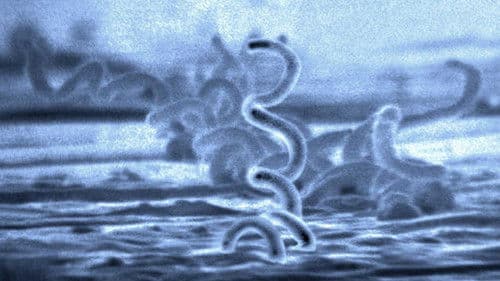 Under Our Skin Bild 1