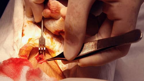 Patient Seventeen Bild 3