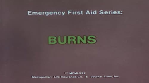 Emergency First Aid Series: Burns Bild 1