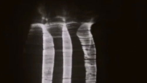 Les achalunés Bild 1