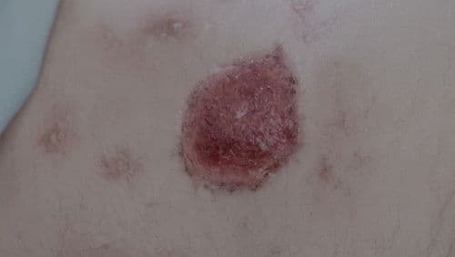 O Pequeno Mal Bild 1