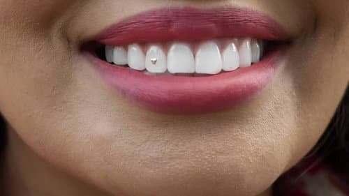 Open Wide Bild 1