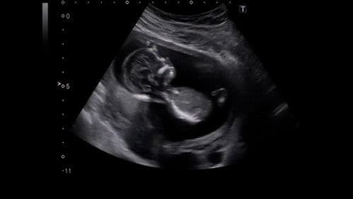 Corpi Estranei Bild 1