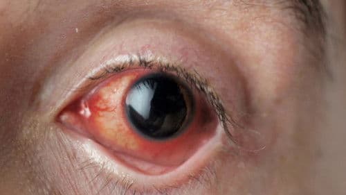 Gözümün Nûru Bild 2