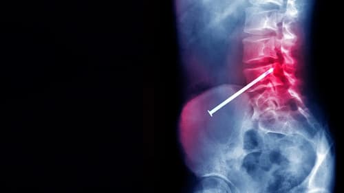 Body Invaders Bild 1