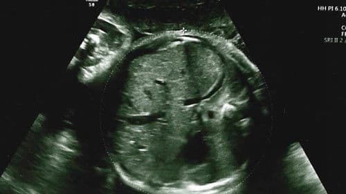 Quiero ser tu madre Bild 7