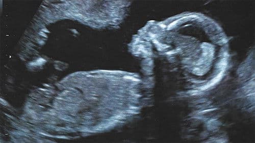 Quiero ser tu madre Bild 4