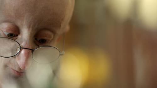 Life According to Sam Bild 1