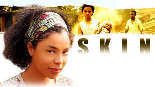 Skin - Schrei nach Gerechtigkeit Bild 7