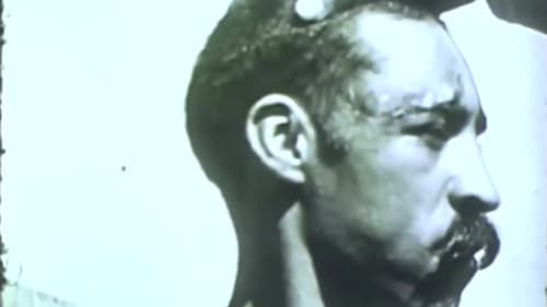 Rabies in a Human Patient Bild 1