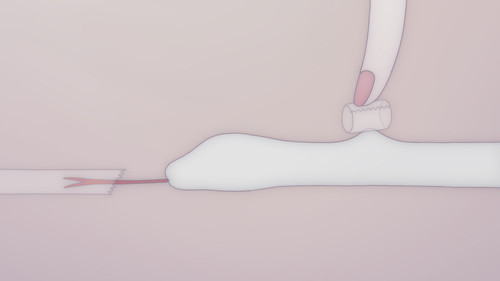 不安 な 体 Bild 1