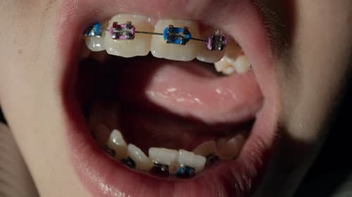 Open Wide Bild 5