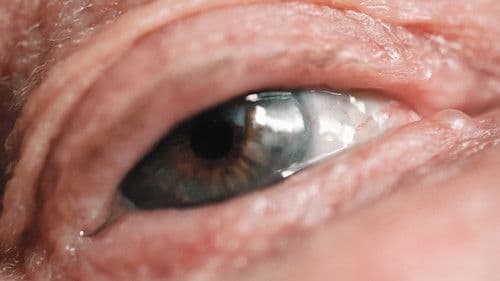 Vanishing before the Inner Eye Bild 6