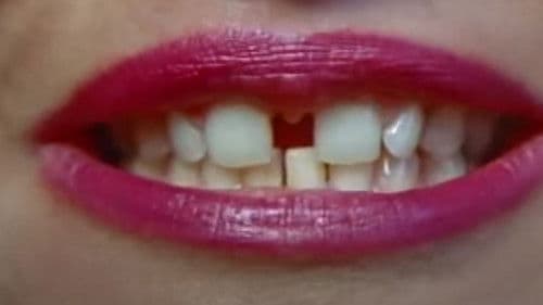 Gap-Toothed Women Bild 2