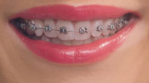 Greener Grass Bild 6