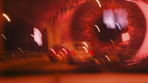 Escopaestesia Bild 4