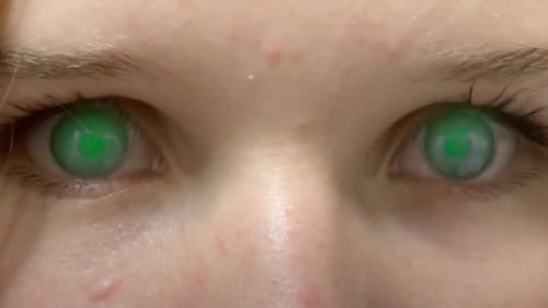 Skittles: No More Games Bild 1