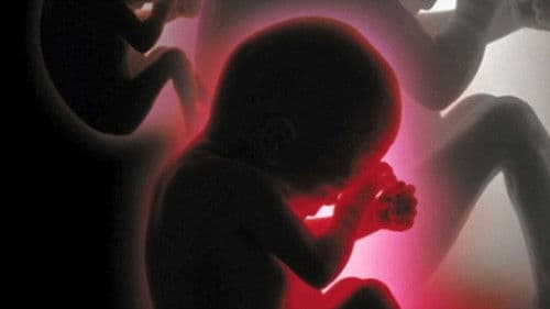 Proyecto Cassandra Bild 1