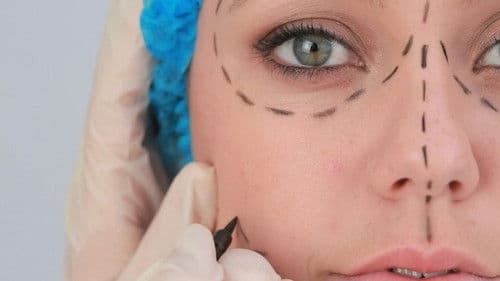 Plastic Surgery Knifemares Bild 1