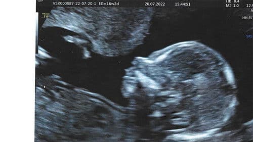 Quiero ser tu madre Bild 3