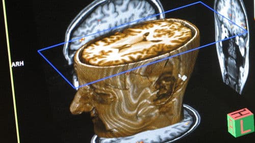 Journey Into Dyslexia Bild 1