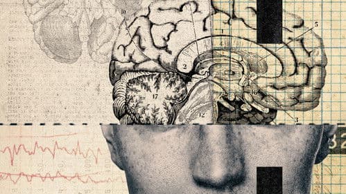 Crazy, Not Insane Bild 3