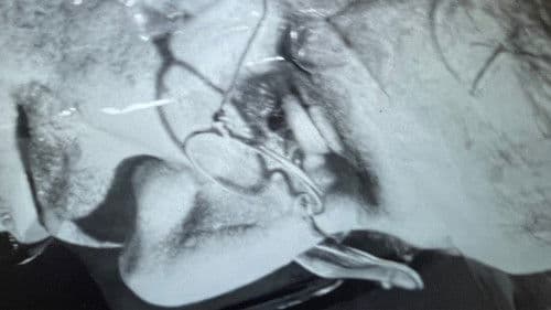 פרנהיים Bild 1