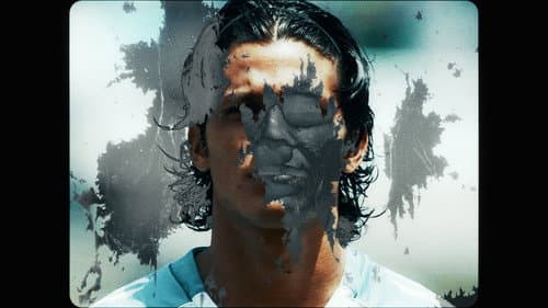 Vitiligo Bild 1