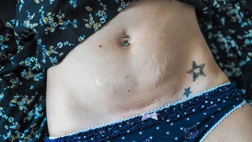 Undo Motherhood Bild 1