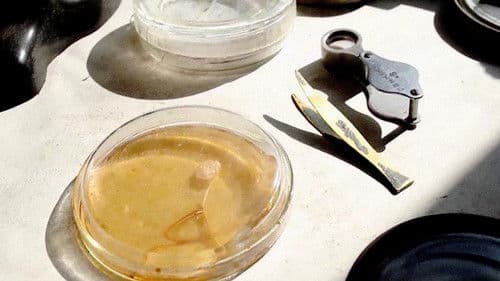 Die Penizillin-Story Bild 1