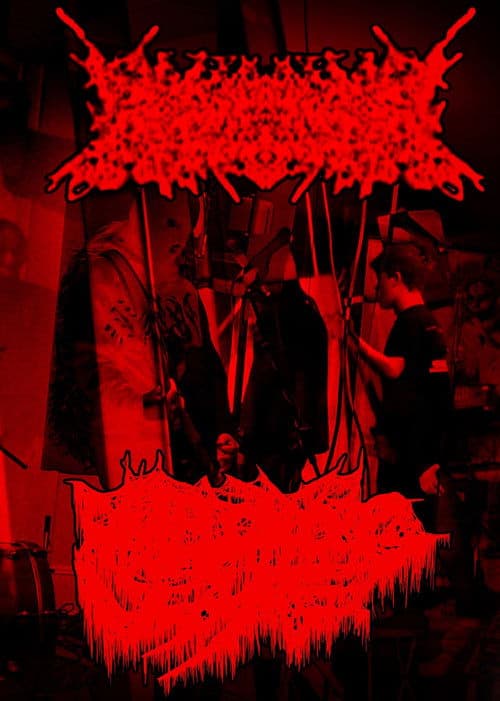 Rhabdomyolysis/Amebiasis Live at The Veil